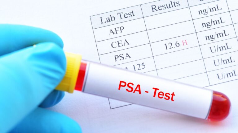 ¿Qué es el PSA y por qué es clave en la detección del cáncer de próstata?